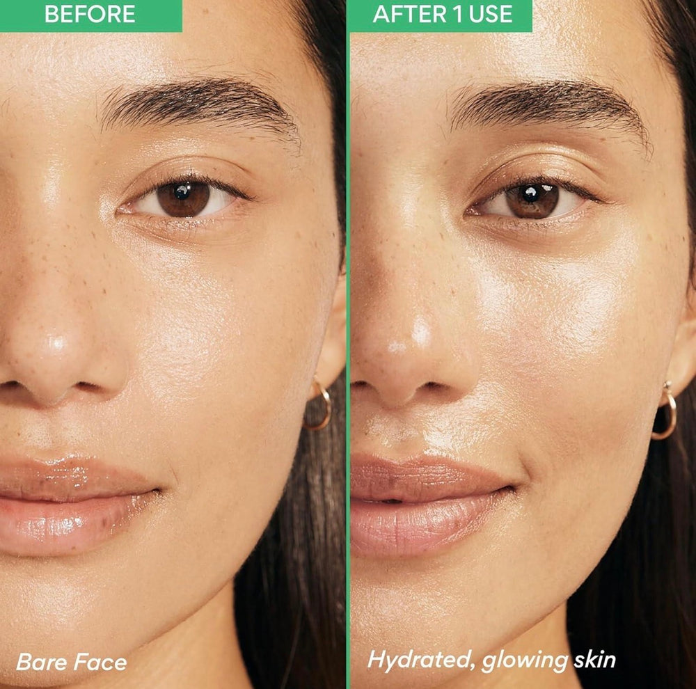 Skin Barrier